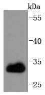 Anti-CDK1 Antibody (2M625)
