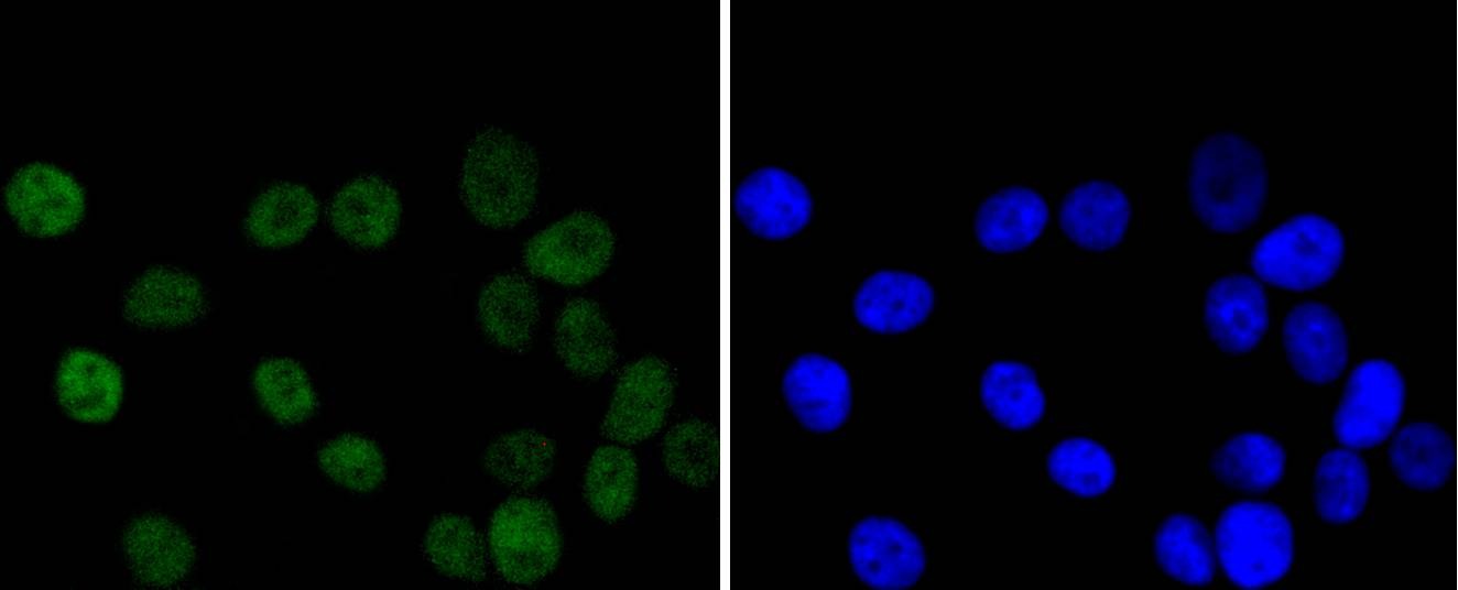 Anti-CHEK2 Antibody (3L509)