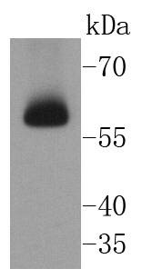 Anti-CHEK2 Antibody (3L509)