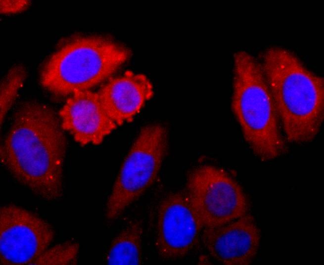 Anti-CDK1 Antibody (2M625)