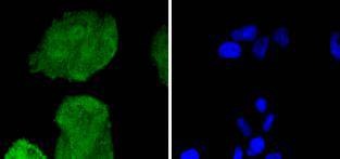 Anti-CDK6 Antibody (5T828)