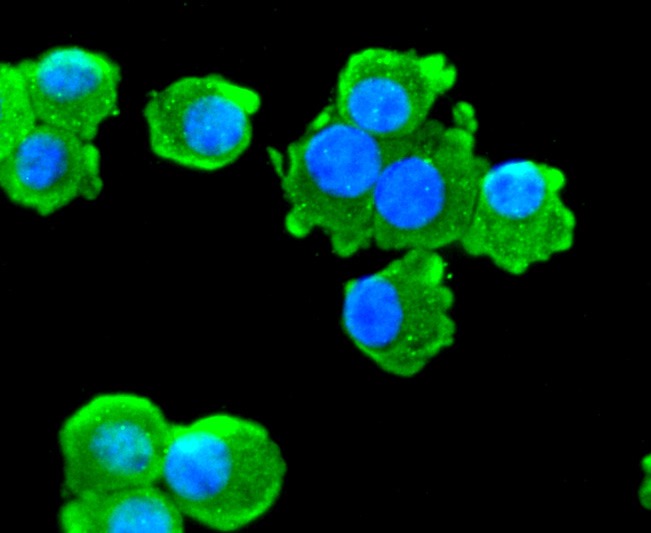Anti-CHAT Antibody (3G910)
