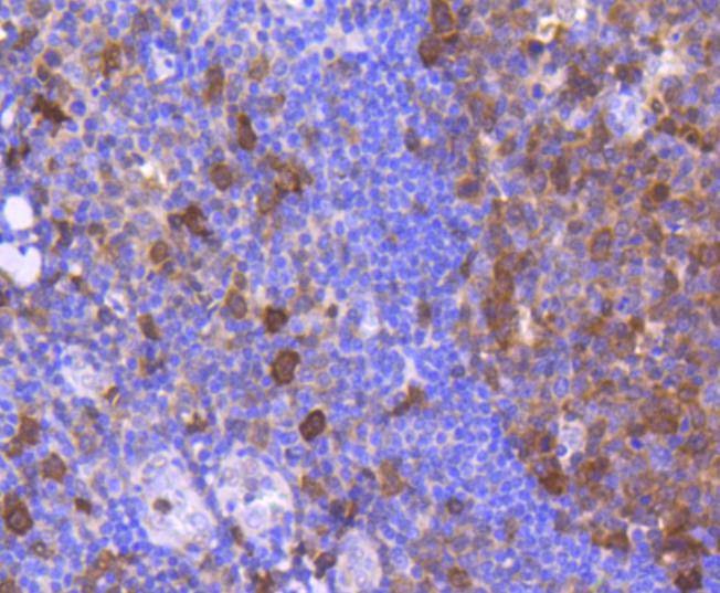 Anti-CDK6 Antibody (5T828)
