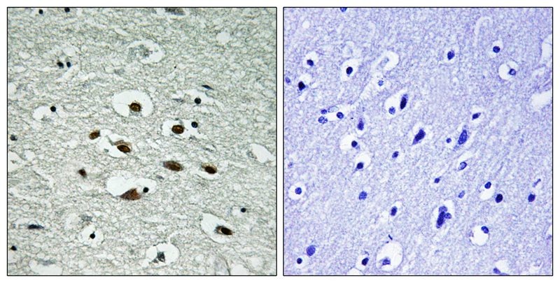 Anti-Phospho-CHEK1 (Ser296) Polyclonal Antibody