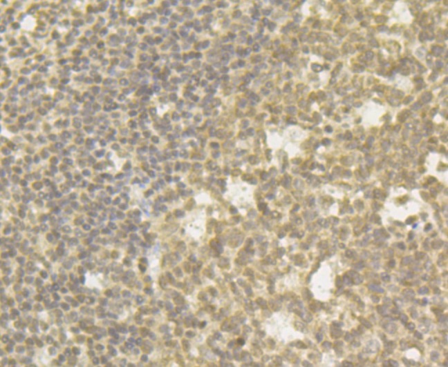 Anti-CHD1L Antibody (7L400)