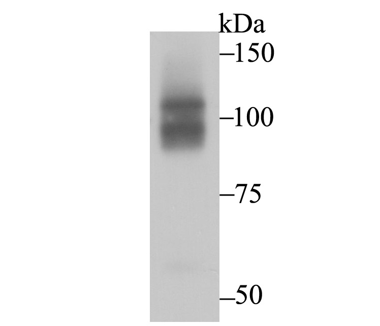 Anti-CHD1L Antibody (7L400)
