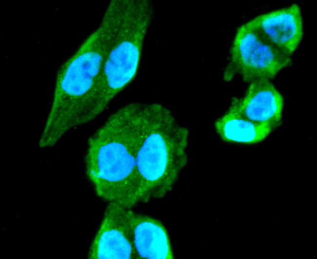 Anti-CHAT Antibody (3G910)