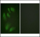 Anti-Phospho-CHEK1 (Ser286) Polyclonal Antibody