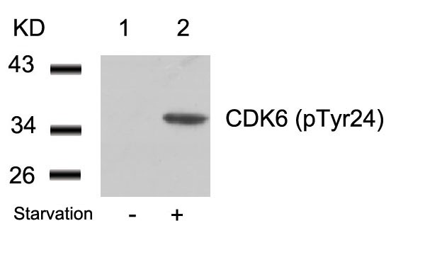 Anti-Phospho-CDK6 (Tyr24) Polyclonal Antibody