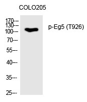Anti-Phospho-KIF11 (Thr926) Polyclonal Antibody