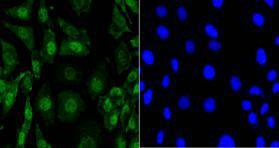 Anti-Eftud2 Antibody (9L848)