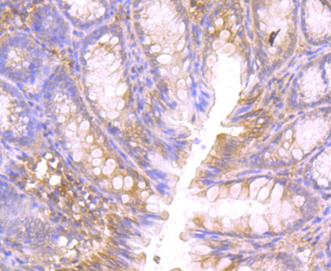 Anti-CTHRC1 Antibody (5Z159)