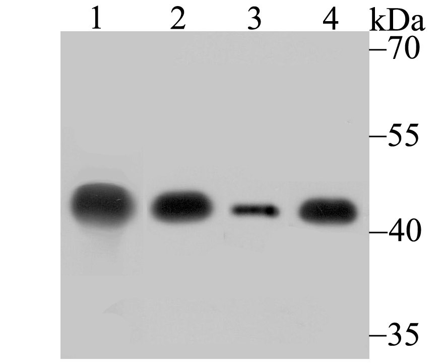 Anti-Creatine kinase B/CKB Antibody (1R5)