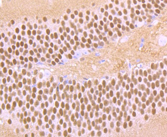 Anti-Ctip2 Antibody (8M731)