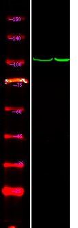 Anti-Phospho-CTNND1 (Tyr257) Polyclonal Antibody