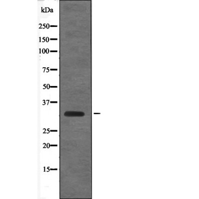 Anti-Phospho-CCND1 (Thr288) Polyclonal Antibody
