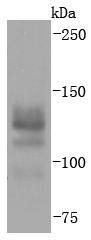 Anti-Ctip2 Antibody (8M731)