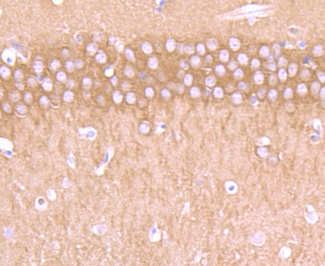 Anti-CRMP1 Antibody (1I169)