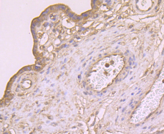 Anti-CTHRC1 Antibody (5Z159)