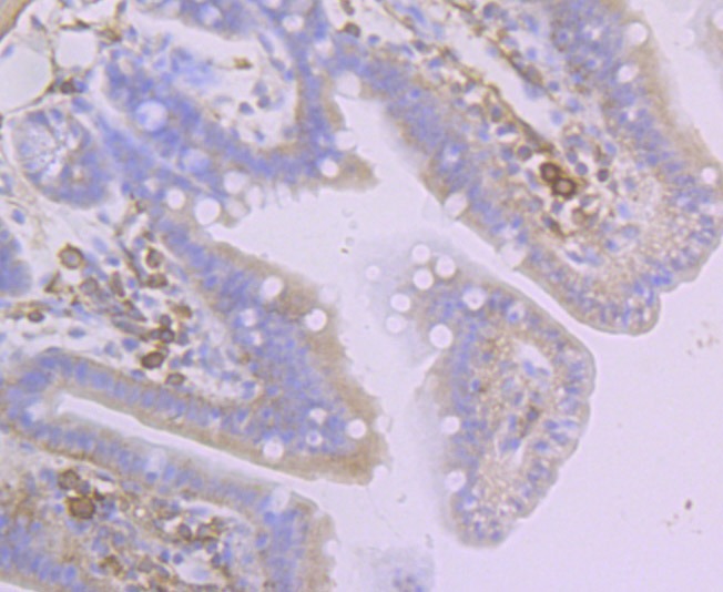 Anti-Creatine kinase B/CKB Antibody (1R5)