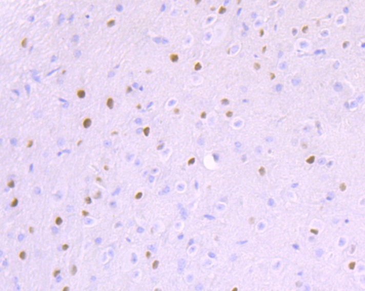 Anti-Ctip1 Antibody (3F515)