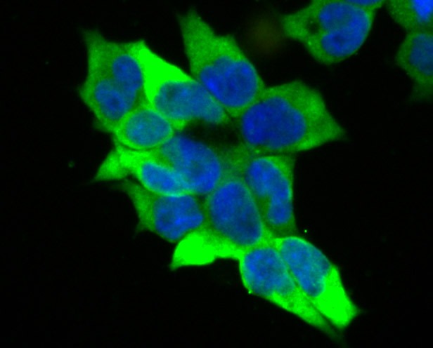 Anti-Creatine kinase B/CKB Antibody (1R5)