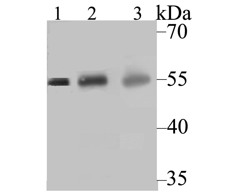 Anti-CYP27A1 Antibody (5U325)