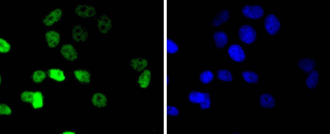 Anti-CCNE1 Antibody (7P753)