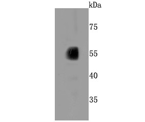 Anti-CYP2E1 Antibody (3A626)