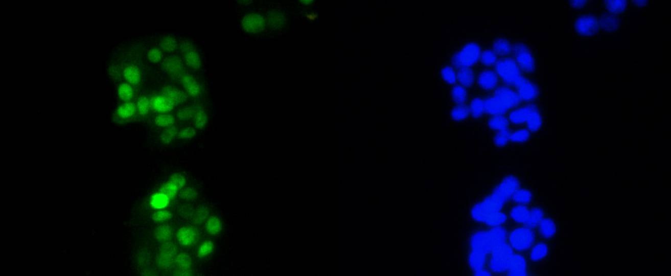 Anti-CCND1 Antibody (4L128)