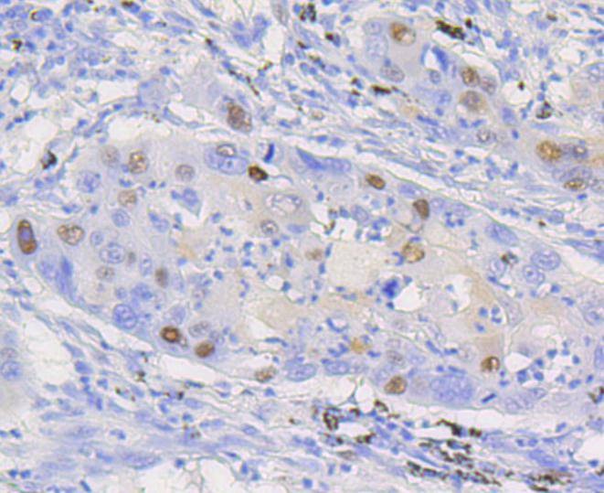 Anti-CCND1 Antibody (4L128)