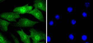 Anti-Cyclin E2 Antibody (2N277)