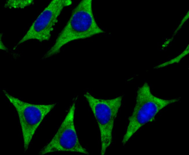 Anti-CYP17A1 Antibody (1U433)