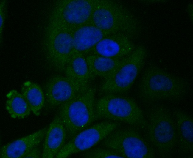 Anti-CYP27A1 Antibody (5U325)