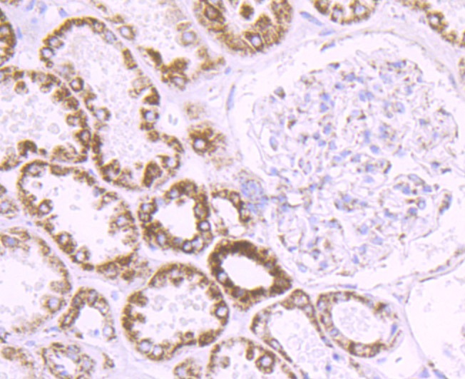 Anti-CYP17A1 Antibody (1U433)