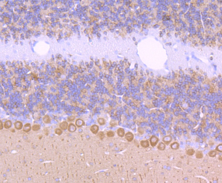 Anti-CRMP1 Antibody (1I169)