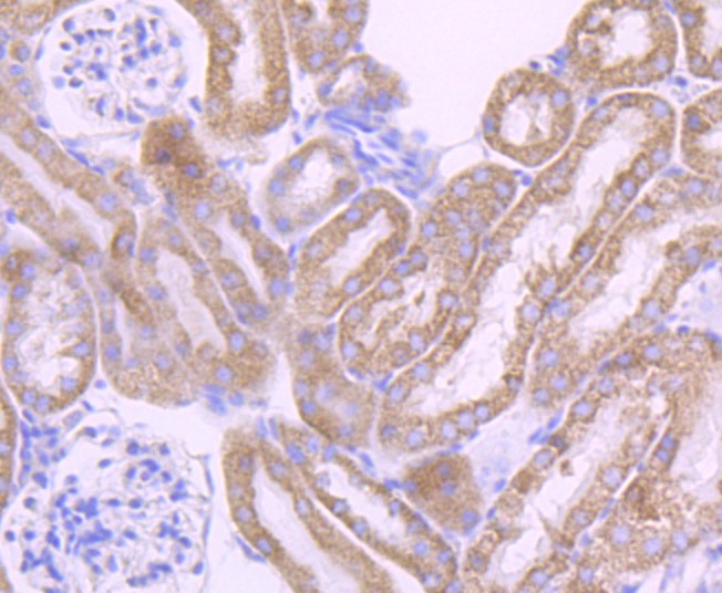 Anti-CYP17A1 Antibody (1U433)