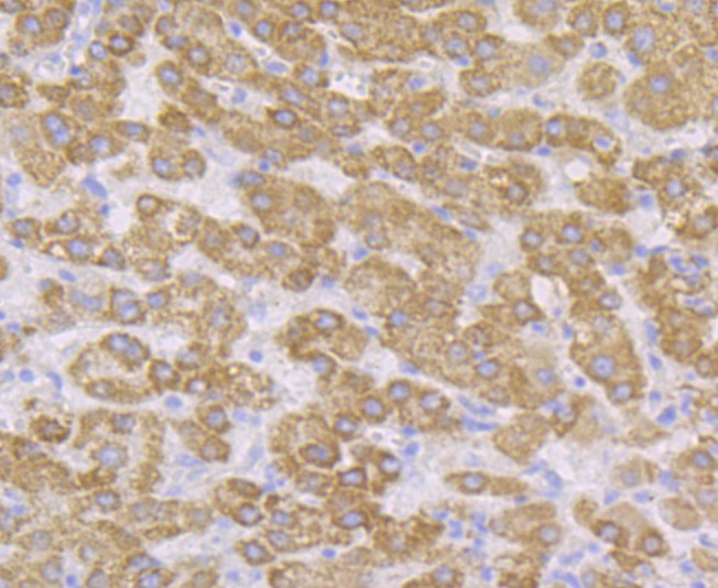 Anti-CYP27A1 Antibody (5U325)