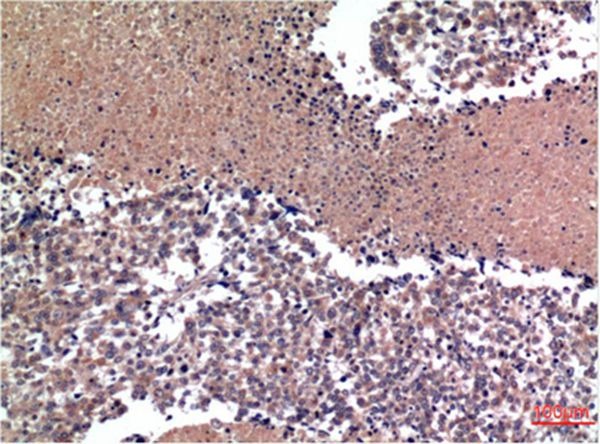 Anti-CCNB1 Antibody (5K945)