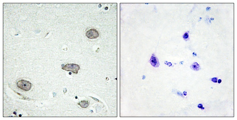 Anti-Phospho-CSF1R (Tyr809) Polyclonal Antibody 3