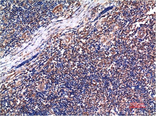 Anti-CCNB1 Antibody (6K114)