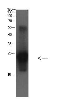 Anti-CST3 Antibody (1L285)