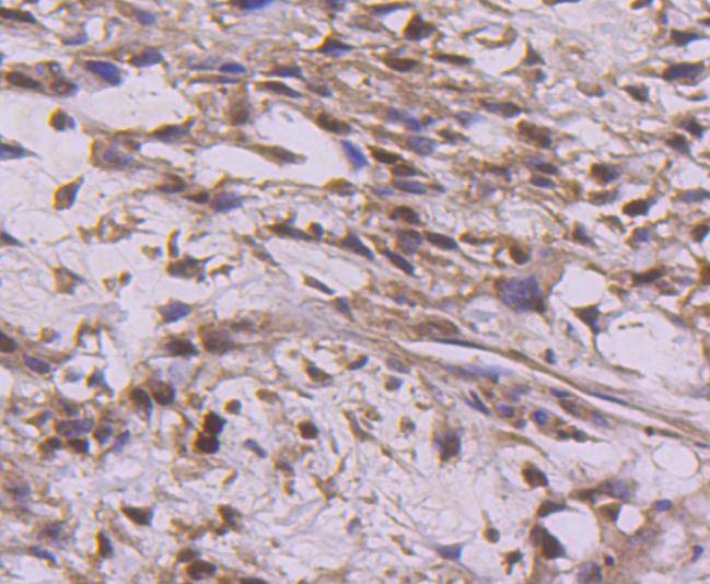 Anti-Cyclin E2 Antibody (2N277)