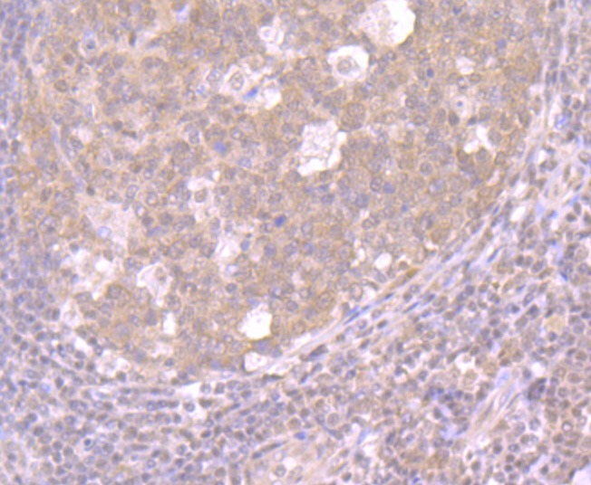 Anti-XPO1 Antibody (2H608)