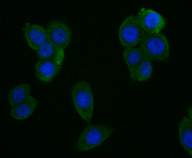 Anti-CYP27A1 Antibody (5U325)