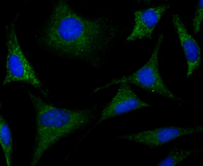 Anti-CRMP1 Antibody (1I169)