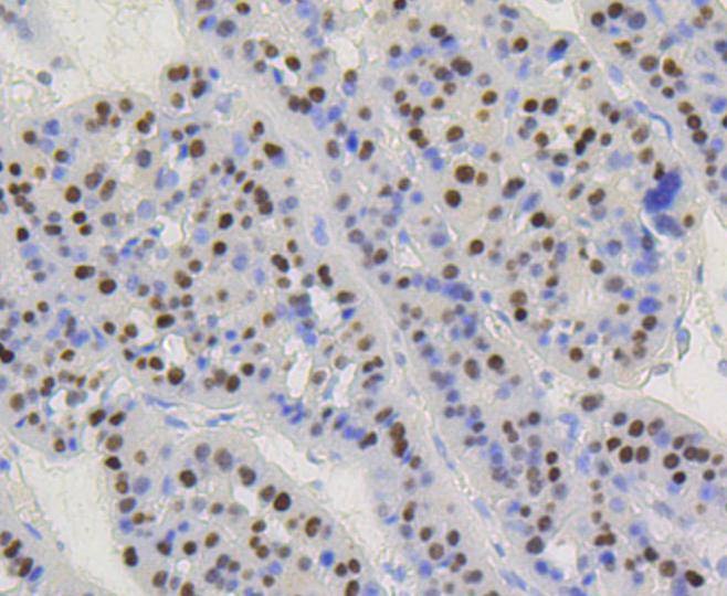 Anti-CCND1 Antibody (4L128)