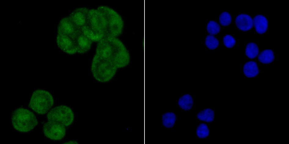 Anti-XPO1 Antibody (2H608)