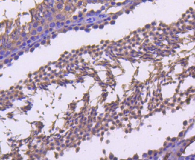 Anti-Cyclin B2 Antibody (9U494)