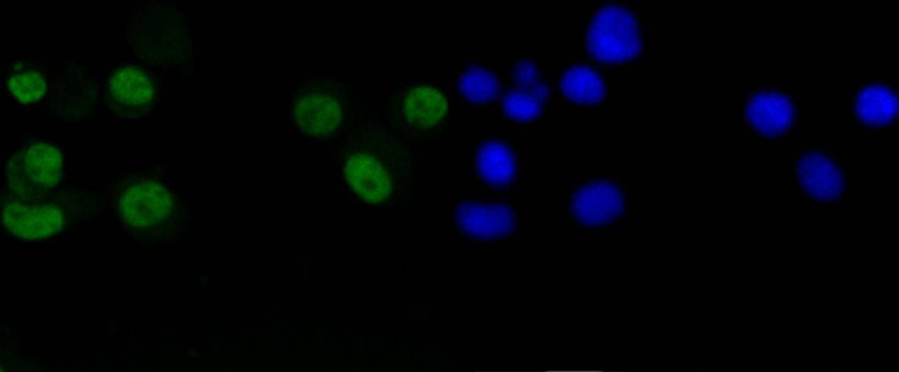 Anti-CCND1 Antibody (4L128)